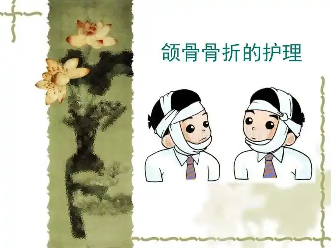 颌骨骨折的护理.pptx 23页