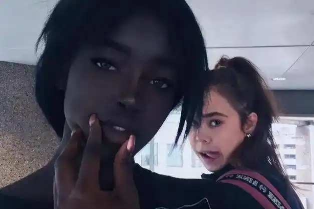 黑人皮肤揭密:美女显微镜之下惊人真相|细胞|肤色|色素|角质层|皮肤