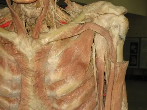 发几张真人解剖的标本照片 - 中医针推外治版 - 爱爱医医学论坛