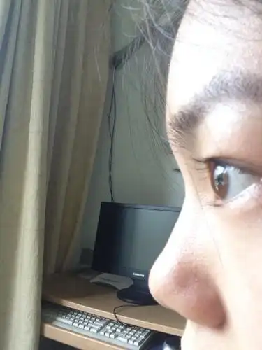 觉得自己眼球突出