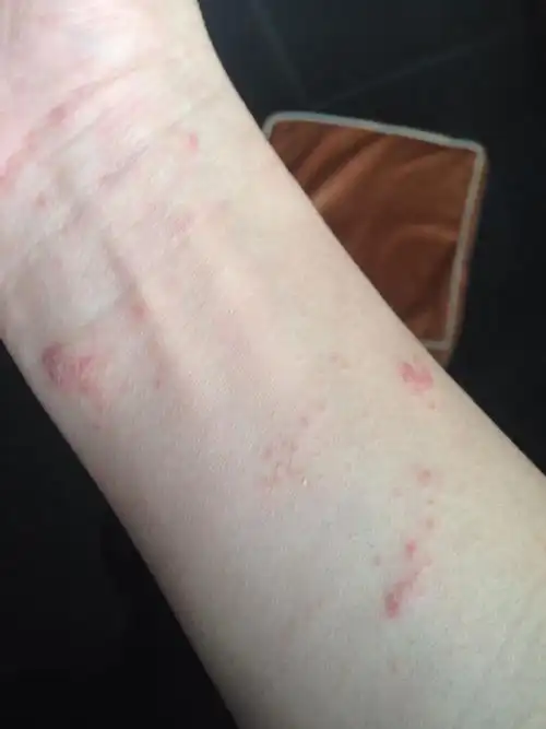 身上很多小红点一周了就是不退!有一点点痒
