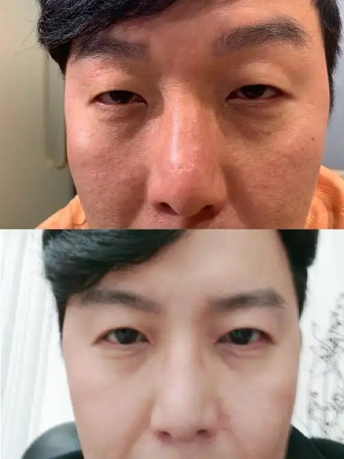 韩国丽颜丽整形外科医院