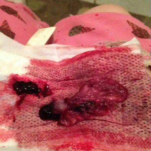 卫生巾上为什么 有血