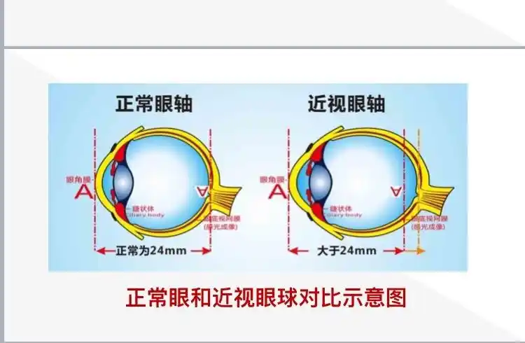每天带娃去户外溜达2小时,是保护宝宝视力的关键.