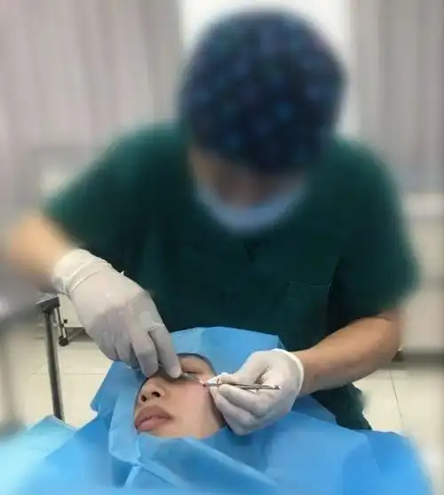 整形手术中如何麻醉