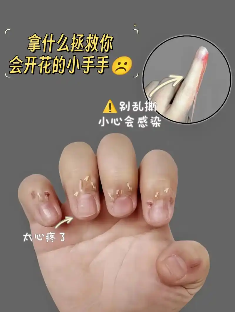 宝宝长倒刺真的太疼太难受了 - 抖音