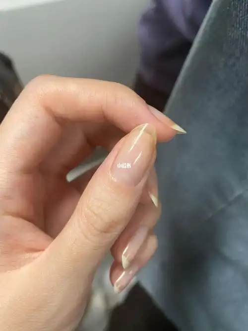 大拇指指甲怎么变透明了