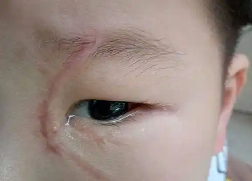 从照片上可以清晰的看到,浩浩脸上血迹