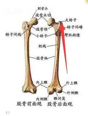 第二种是大腿宽:一般肉肉多的女性都会有大腿宽的现象,他的宽表现在会
