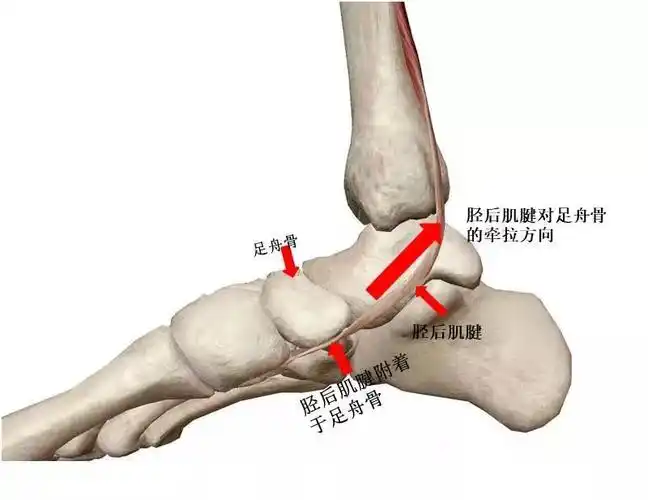 详解小儿扁平足|舟骨|足部|治疗|扁平足|足弓|-健康界