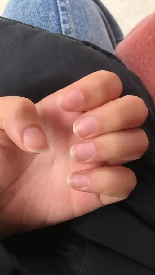 为什么指甲这么宽