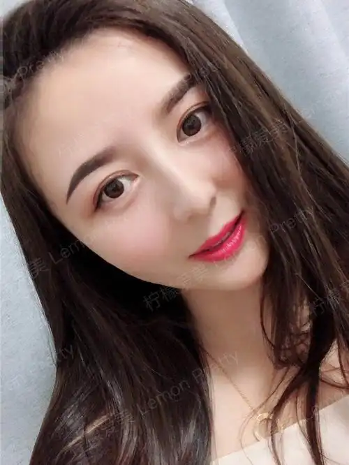 玻尿酸全脸填充究竟是啥概念?