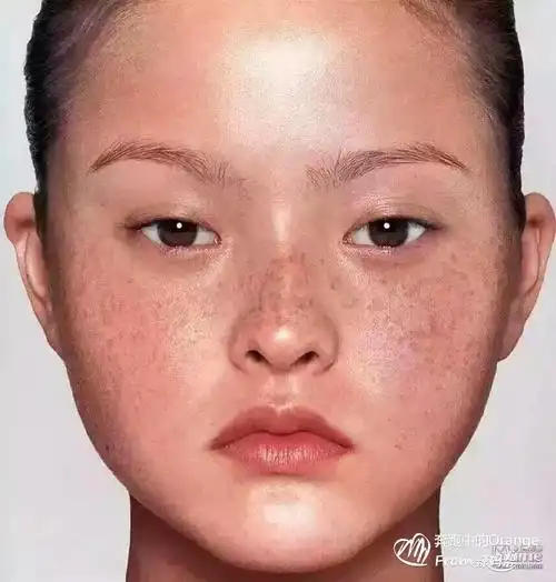 女人长斑的位置图解(黄褐斑怎样才能彻底的去掉)