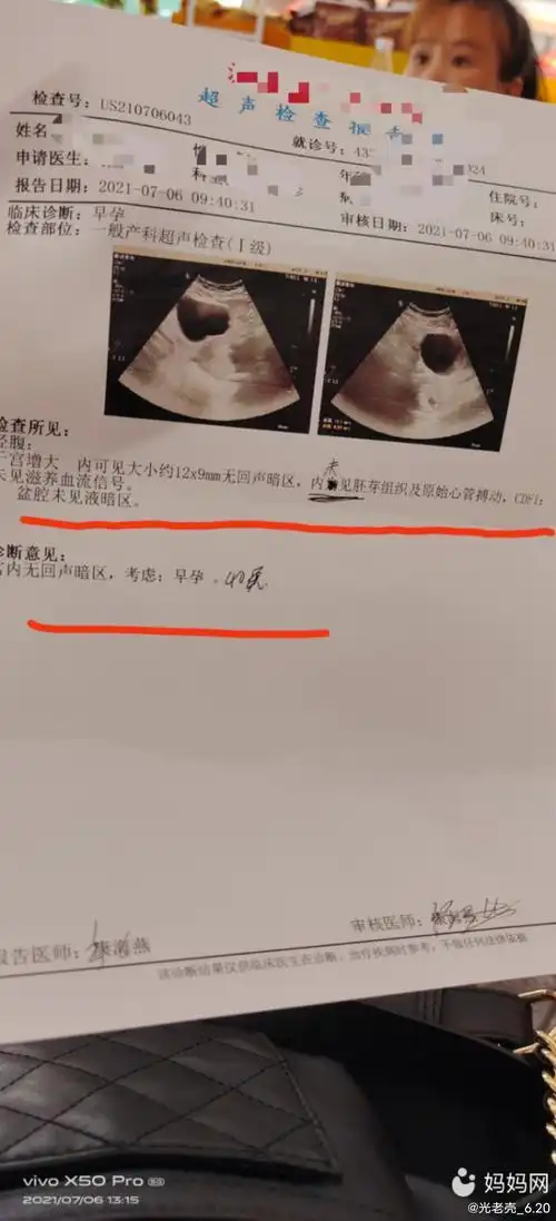 45天了,今天到照b超,却看不到孕囊.什么情况.