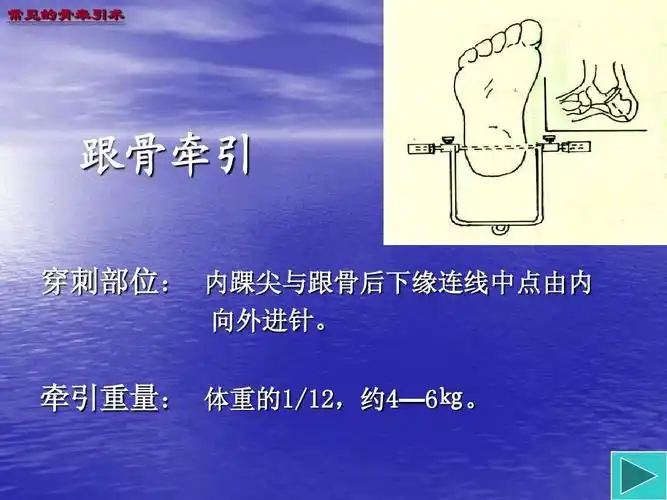 牵引病人的护理ppt