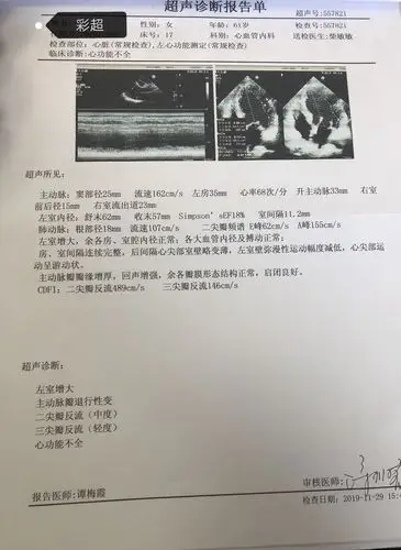 心脏彩超.ef值18%.
