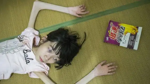 12岁女孩瘦成皮包骨,父亲残忍抛弃她,听说一消息后跪地求原谅