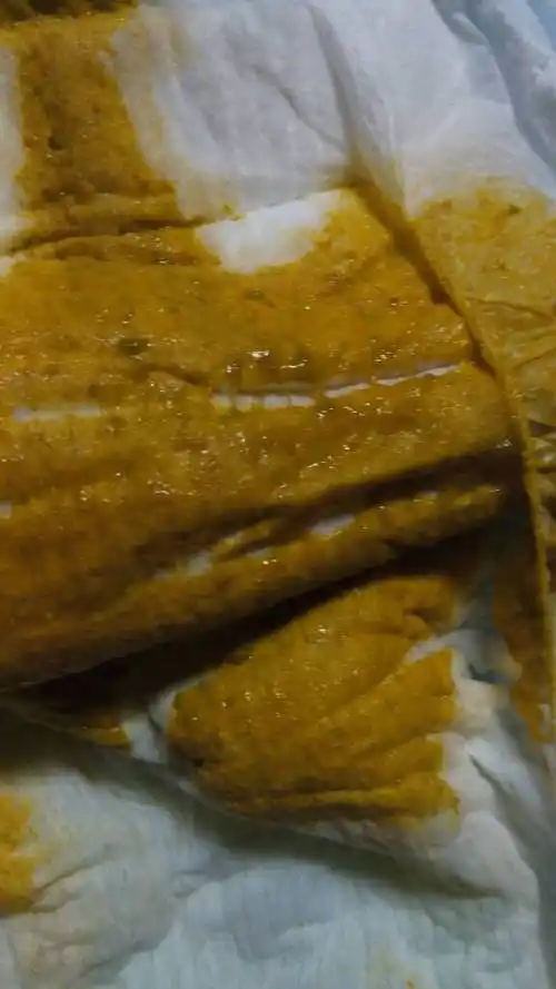 要注意卫生,可 以用点妈咪爱的,必要时可以到医院去查一个大便常规的