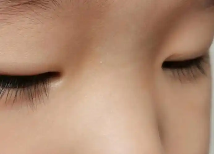 刘亦菲们,宝宝两岁多了,这样还能长出双眼皮吗?这是内双?