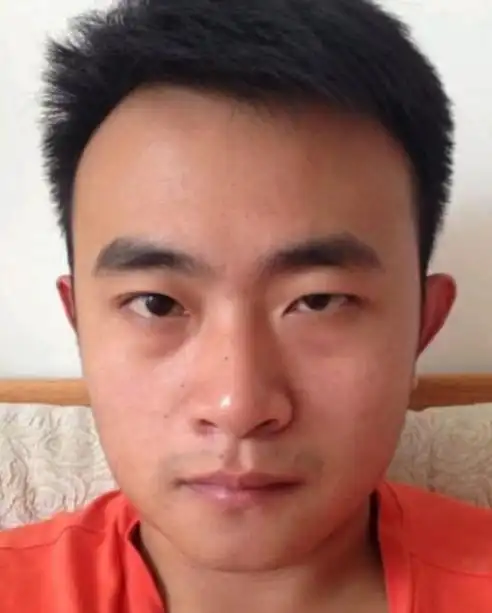 眼睛一大一小怎么办71