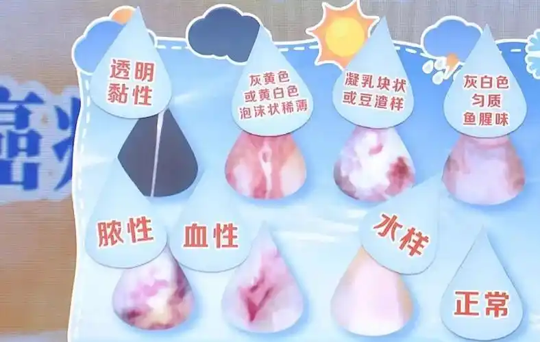 内裤发黄结痂正常吗伴有这些情况一定要小心