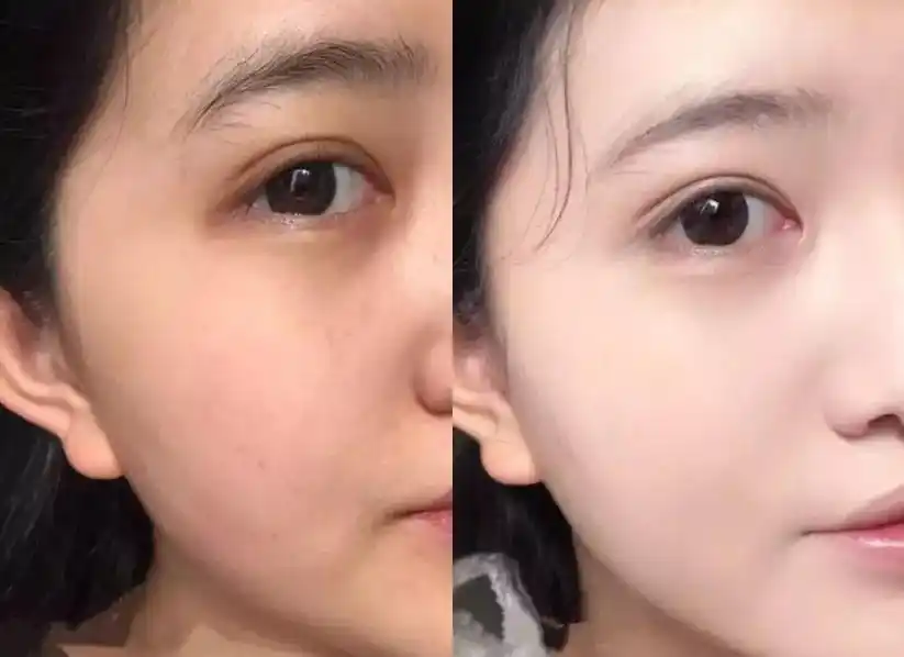 晒黑怎么白回来,总结一些有效的方法,帮助晒黑的皮肤变回白皙