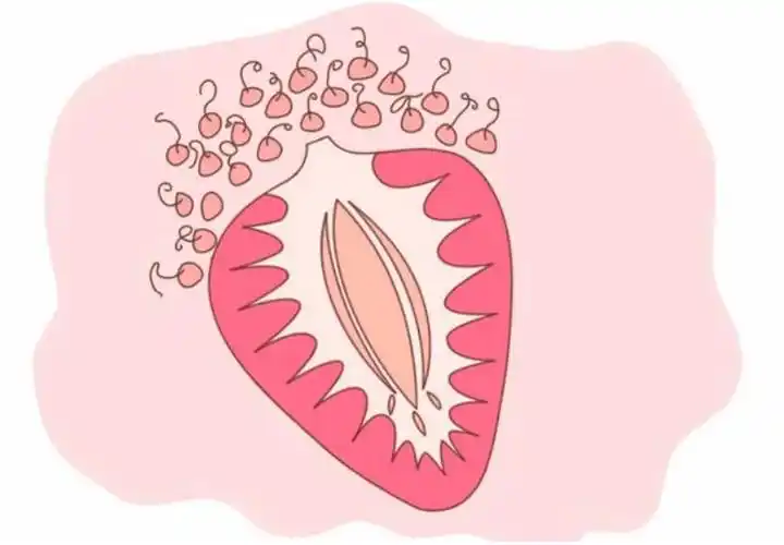 可以治疗外阴白斑病吗?_皮肤_患者_免疫