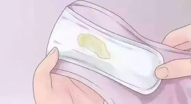 上完厕所看内裤医生3种异常分泌物警惕子宫病变
