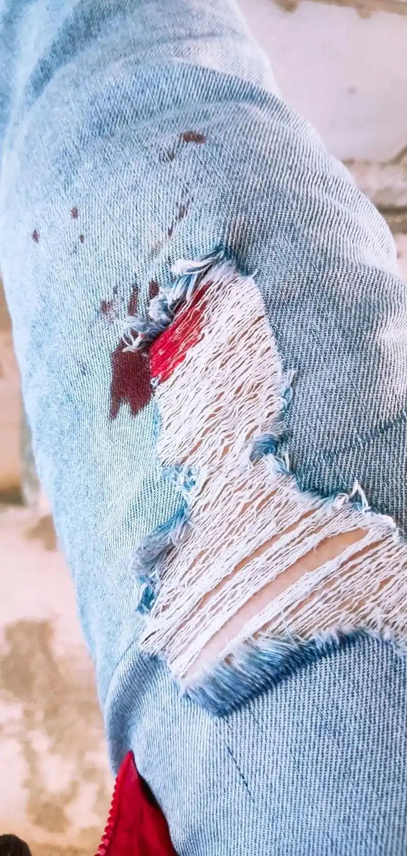 为啥受伤的总是你,一不小心撞标准节上了,腿在流血心在滴血,看 - 抖音