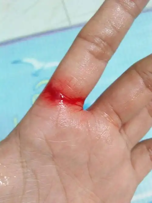 我不小心用切手木薯啊.我不小心切菜刀木薯