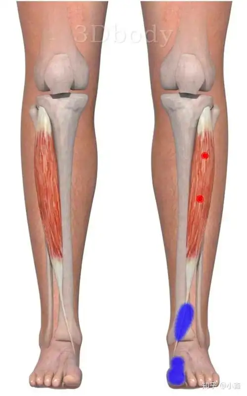 胫骨前肌 「 触发点疗法 」