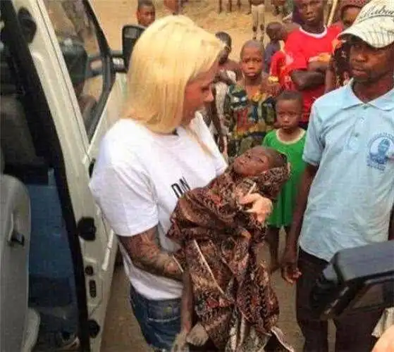 曾经饿得皮包骨的网红男孩后来被好心人收养5年后成这样