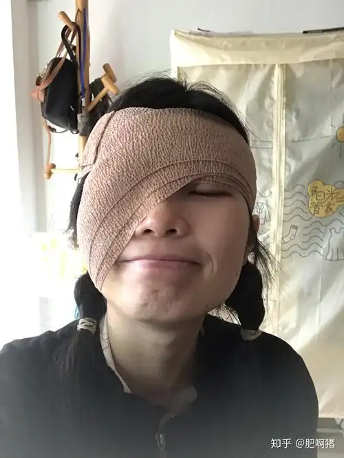 手术当天术后第二天再去医院换药,换了绷带和药,其实就是检查眼睛,滴