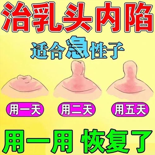 乳头内陷纠正器乳房矫正器乳头凹陷矫正器产妇孕妇乳头矫正器医用