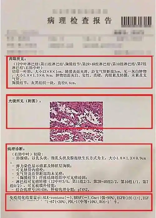 肉眼所见肉眼所见是手术标本送到病理科后由病理医生所看到的肿瘤标本