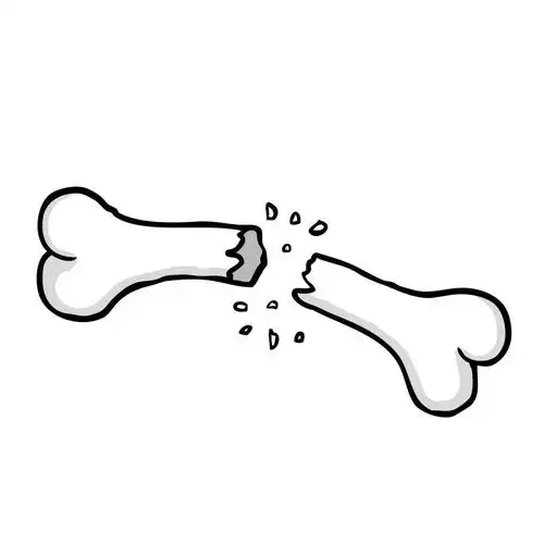 断的骨,绘断的骨,矢量图