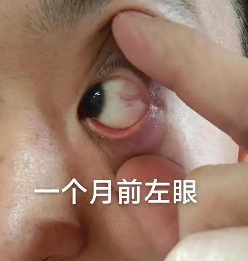 快看看你们的眼睛还干净吗?