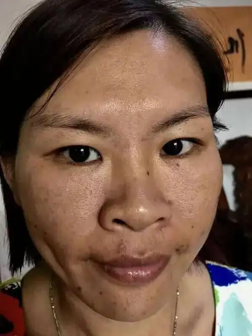 护肤品,农忙时干农活,不农忙就卖棉花糖,典型中国农村妇女黄脸婆的脸