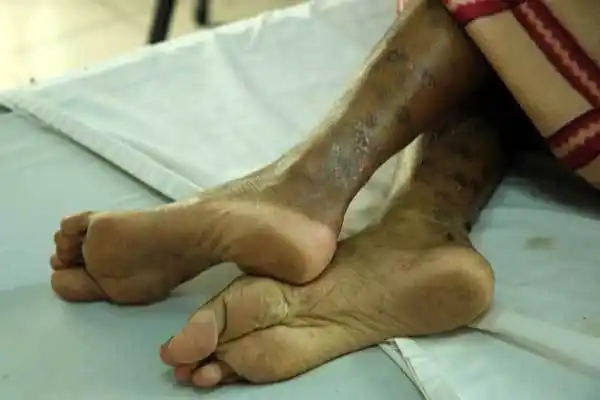 探访泰国艾滋病寺庙[组图]