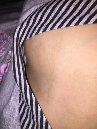 最近发现胸口长了一大片这种黑色的斑.请问这是什么阿?会消掉吗?