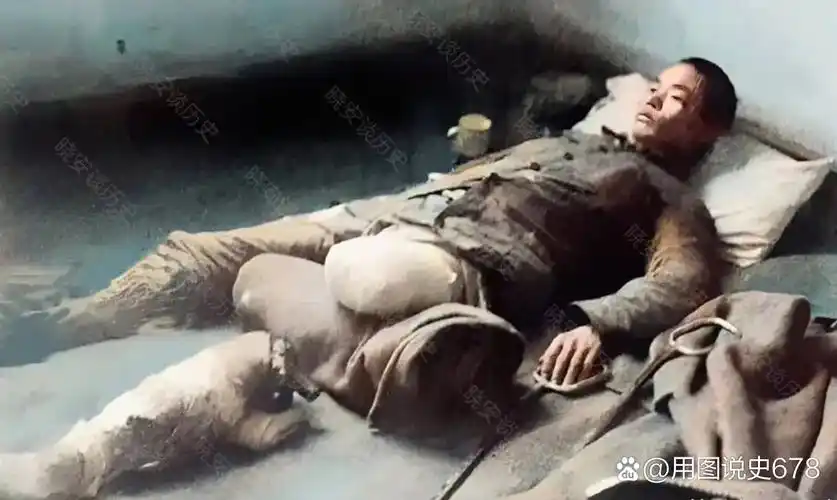 这张照片拍摄于1938年3月,台儿庄作战中,不幸失去左腿的中国军人