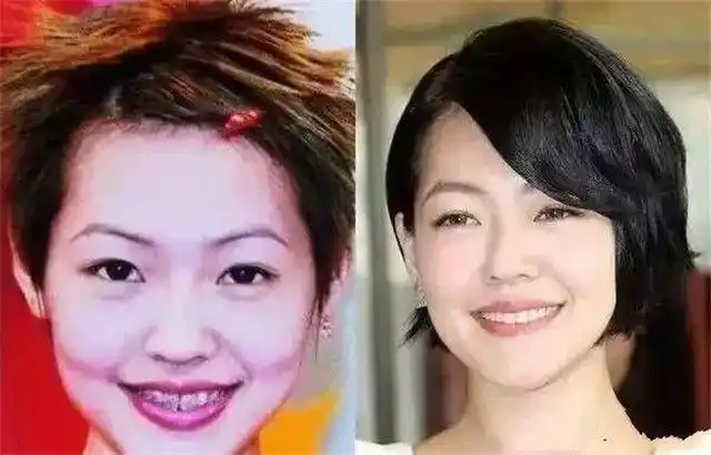 吴昕喝多大曝全明星必整项目胡海泉听后笑出一口璀璨大白牙