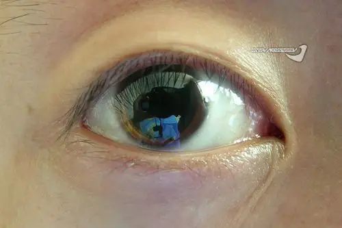 同仁散瞳验光记