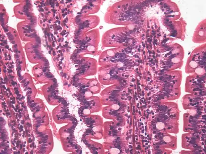 小肠绒毛光镜照片