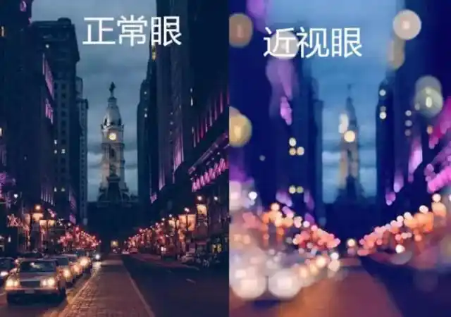 西安佰视佳| 西安眼科医院| 佰视佳眼科| 近视手术 | 近视眼手术的