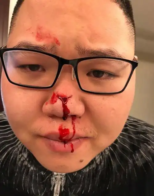 pdd爆料被车撞得满身是血但没有追责车主背后的原因令人感动