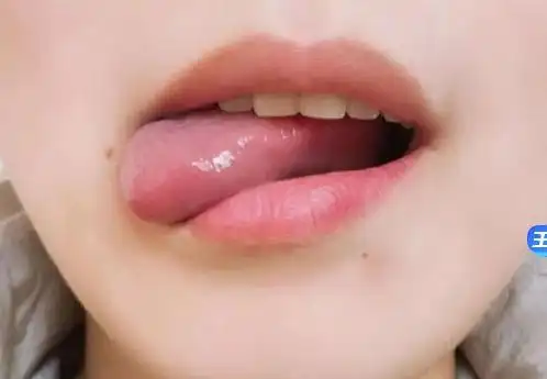 舌头运动训练的要领运用食物玩具言语矫治工具家长要收藏