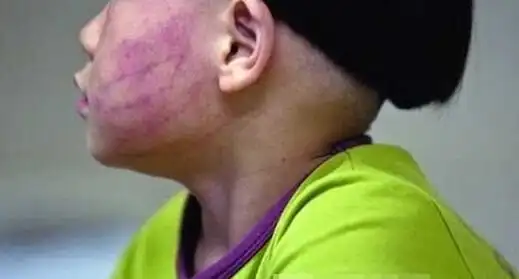 女幼师被曝脚踢幼儿 又见虐童好心塞