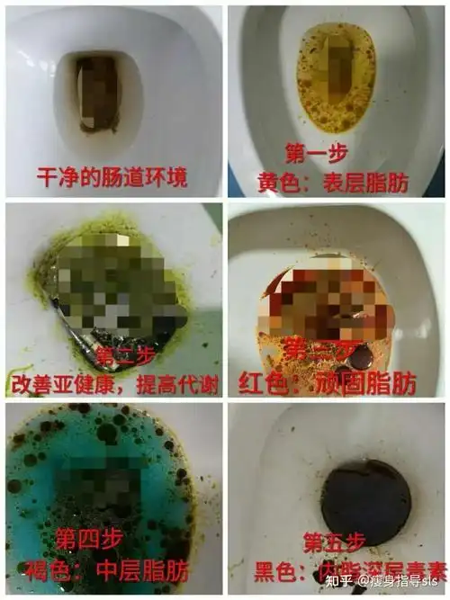 赛乐赛是脂肪酶抑制剂,脂肪酶的活性一旦遭到阻碍,食物中的脂肪便无法