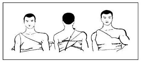 三角巾包扎肘,膝:将三角巾折成适当宽度的带形,将带的中部斜放于伤部